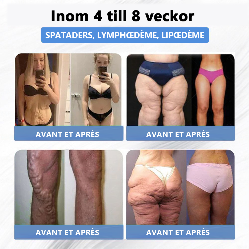 Boutique officielle🇨🇦 | 𝐓𝐡𝐨𝐧𝐞𝐬𝐫®🏪GLP-1 sept en un Solution de santé en liquide oral  (Pour l'obésité, la santé cardiovasculaire, le diabète, l'apnée du sommeil, la santé intestinale, les tissus conjonctifs, et plus encore)