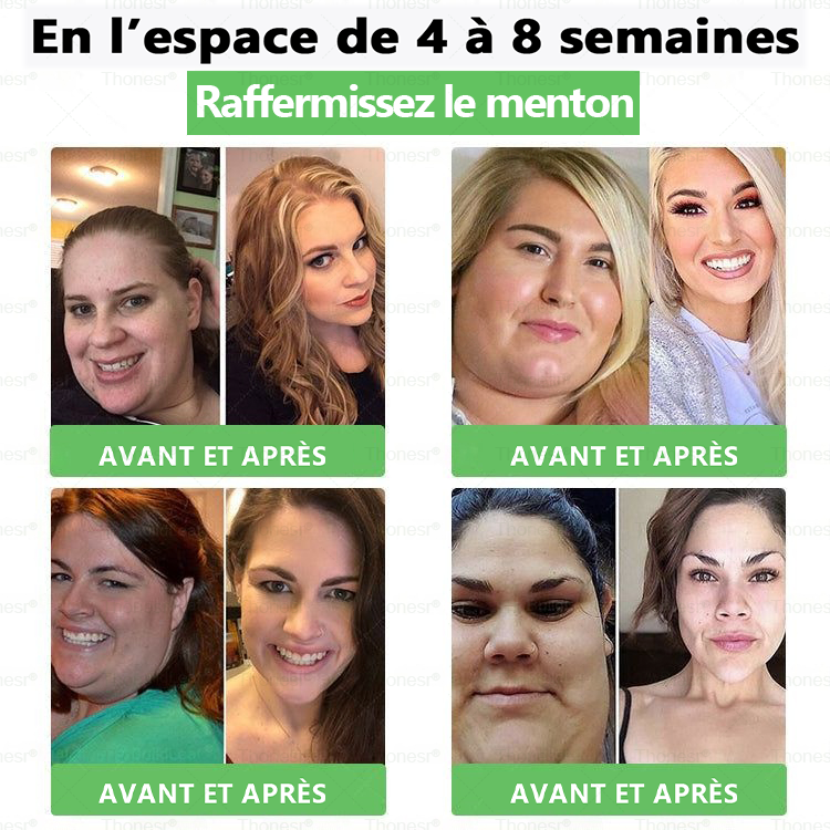 🗽✨𝐄𝐟𝐟𝐢𝐜𝐚𝐜𝐢𝐭é 𝐜𝐥𝐢𝐧𝐢𝐪𝐮𝐞𝐦𝐞𝐧𝐭 𝐩𝐫𝐨𝐮𝐯é𝐞 | 𝐓𝐡𝐨𝐧𝐞𝐬𝐫® 𝐆𝐋𝐏-𝟏 𝐀𝐦𝐢𝐧𝐜𝐢𝐬𝐬𝐞𝐦𝐞𝐧𝐭 𝐞𝐭 𝐬𝐚𝐧𝐭é 𝐒𝐎𝐋𝐔𝐓𝐈𝐎𝐍𝐒 𝐎𝐑𝐀𝐋𝐄𝐒 𝐏𝐎𝐔𝐑 𝐋𝐀 𝐏𝐄𝐑𝐓𝐄 𝐃𝐄 𝐏𝐎𝐈𝐃𝐒Pour lutter contre l'obésité tenace, l'hypertension, l'hyperglycémie, la stéatose hépatique, le relâchement cutané, etc.👩‍⚕️