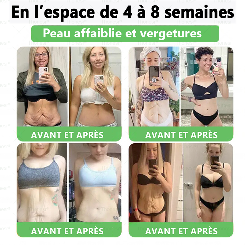 🗽✨𝐄𝐟𝐟𝐢𝐜𝐚𝐜𝐢𝐭é 𝐜𝐥𝐢𝐧𝐢𝐪𝐮𝐞𝐦𝐞𝐧𝐭 𝐩𝐫𝐨𝐮𝐯é𝐞 | 𝐓𝐡𝐨𝐧𝐞𝐬𝐫® 𝐆𝐋𝐏-𝟏 𝐀𝐦𝐢𝐧𝐜𝐢𝐬𝐬𝐞𝐦𝐞𝐧𝐭 𝐞𝐭 𝐬𝐚𝐧𝐭é 𝐒𝐎𝐋𝐔𝐓𝐈𝐎𝐍𝐒 𝐎𝐑𝐀𝐋𝐄𝐒 𝐏𝐎𝐔𝐑 𝐋𝐀 𝐏𝐄𝐑𝐓𝐄 𝐃𝐄 𝐏𝐎𝐈𝐃𝐒Pour lutter contre l'obésité tenace, l'hypertension, l'hyperglycémie, la stéatose hépatique, le relâchement cutané, etc.👩‍⚕️